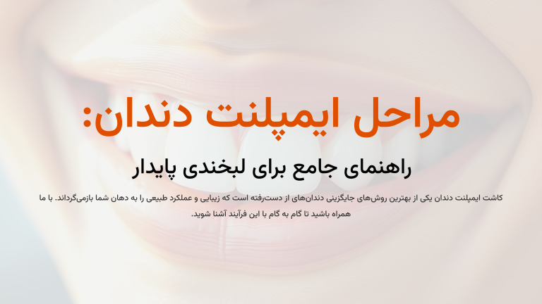 مراحل ایمپلنت دندان
