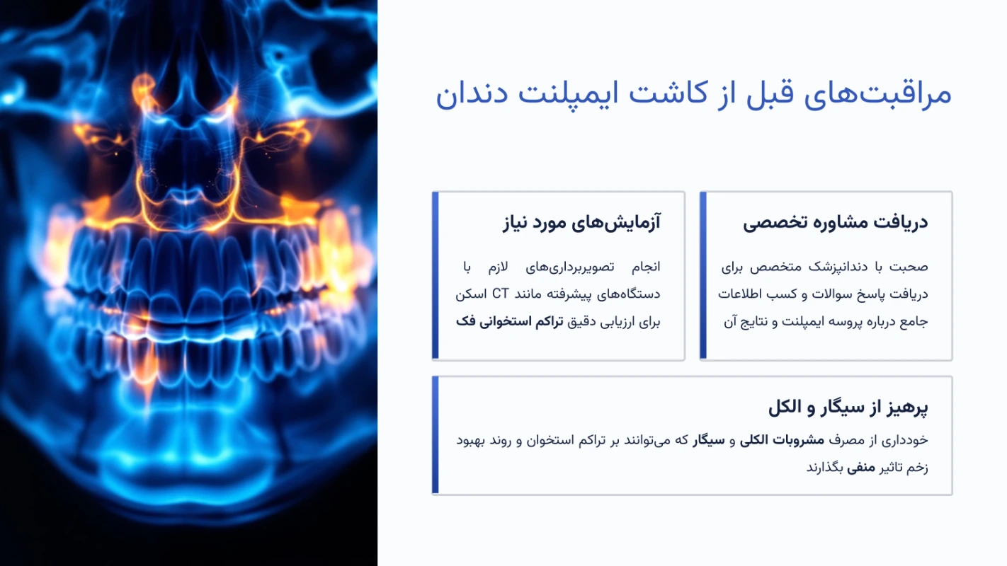 مراقبتهای قبل از کاشت ایمپلنت دندان