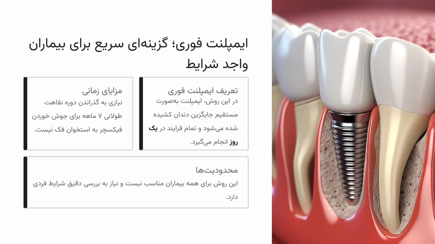 ایمپلنت فوری؛ گزینهای سریع برای بیماران واجد شرایط