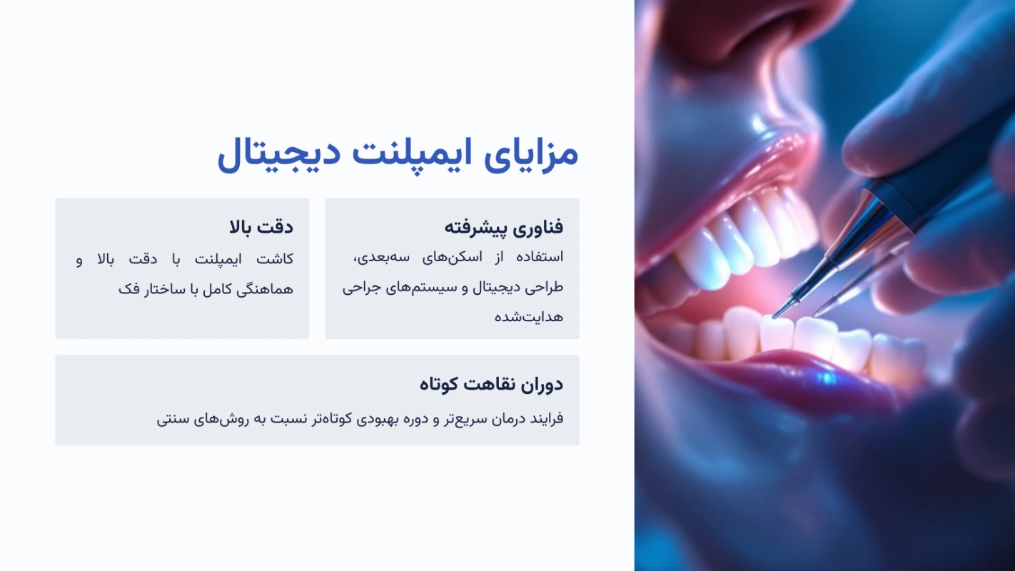 مزایای ایمپلنت دیجیتال