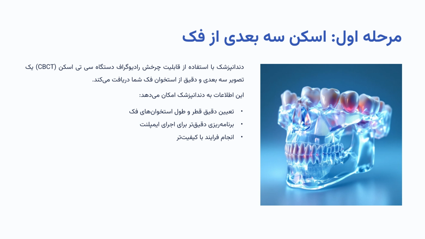 مرحله اول ایمپلنت دیجیتال؛ اسکن سه بعدی از فک