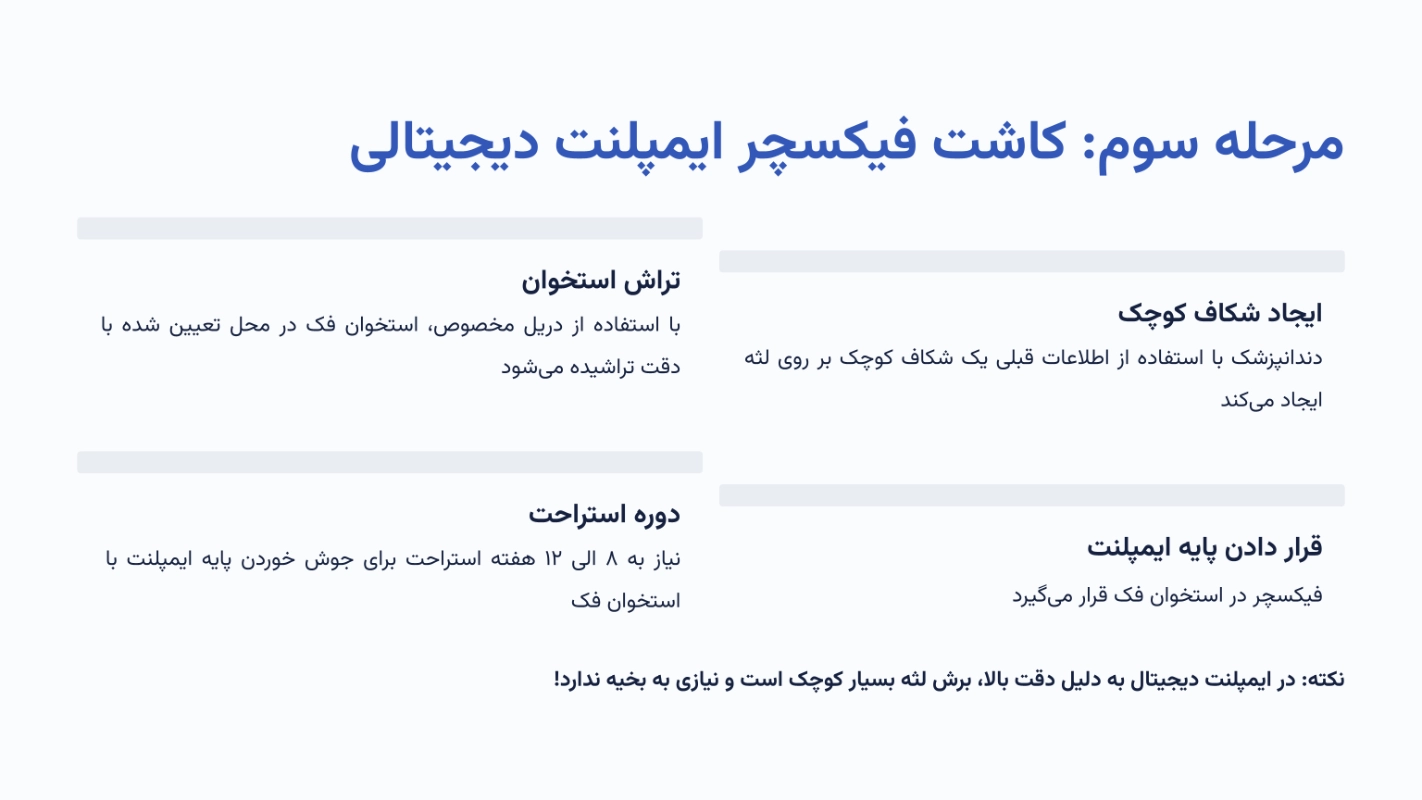 مرحله سوم؛ کاشت فیکسچر ایمپلنت دیجیتالی