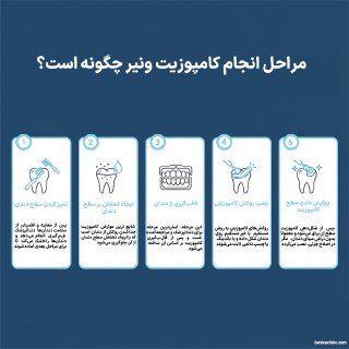 در این تصویر در رابطه با 5 مرحله اصلی ونیر کامپوزیت صحبت شده است.