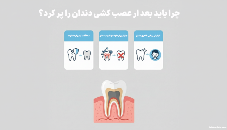 در این تصویر در رابطه با 3 مورد از مهمترین دلایل پر کردن بعد از عصب کشی صحبت شده است.