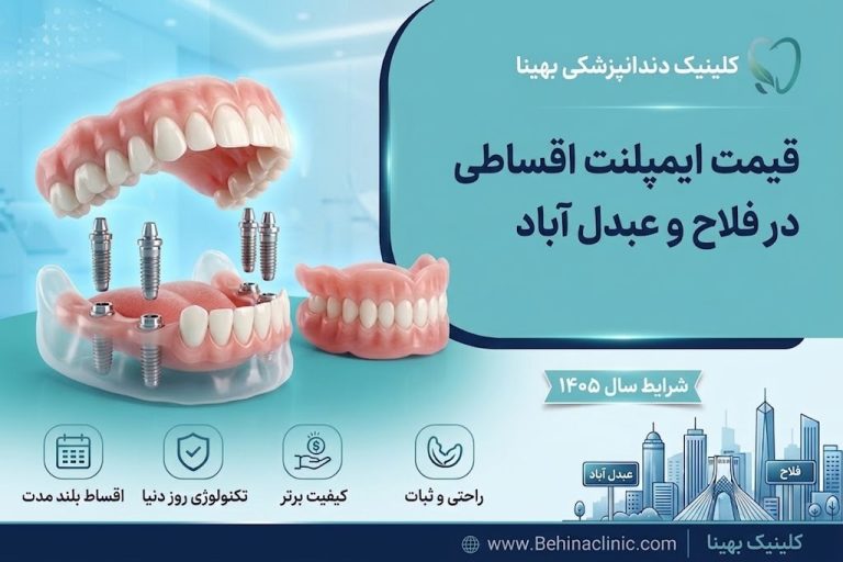 قیمت ایمپلنت اقساطی در فلاح و عبدل آباد