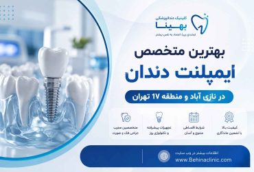 بهترین متخصص ایمپلنت دندان در نازی آباد