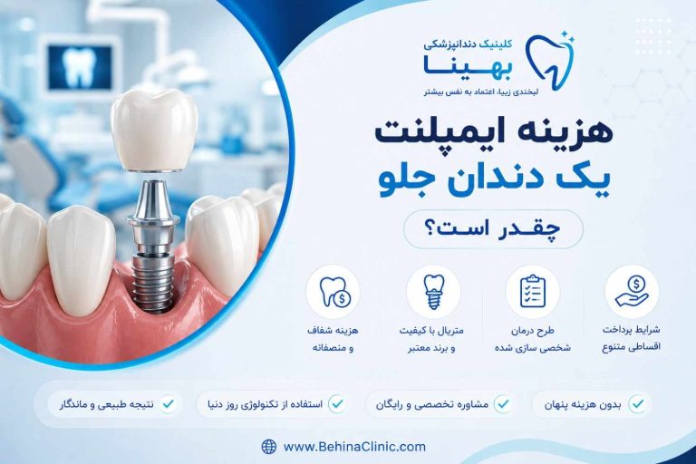 هزینه ایمپلنت یک دندان جلو چقدر است؟