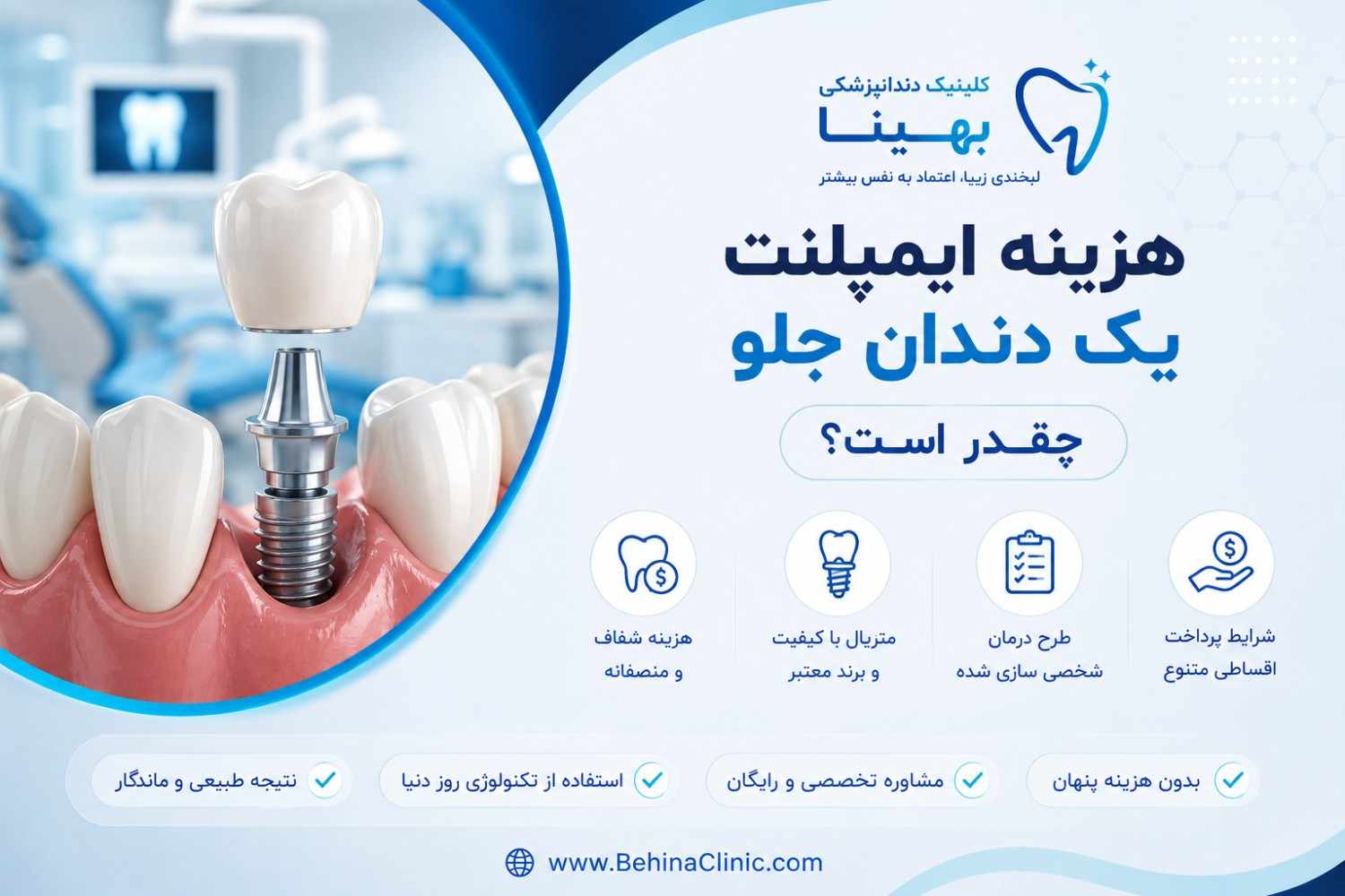 هزینه ایمپلنت یک دندان جلو چقدر است؟
