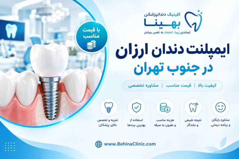 خدمات ایمپلنت دندان ارزان در جنوب تهران